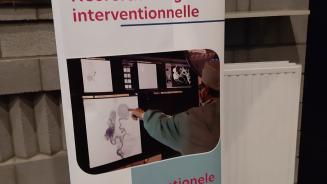 20 ans neuroradiologie interventionnelle 1